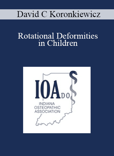 David C Koronkiewicz - Rotational Deformities in Children